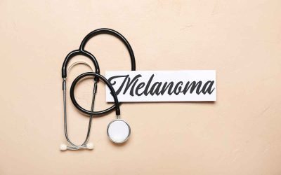The Mechanics of Melanoma